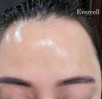 Evercell Deep Wrinkle Solution Cream 10ml