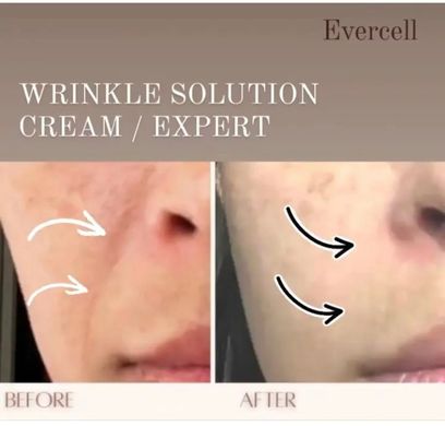 Evercell Deep Wrinkle Solution Cream 10ml