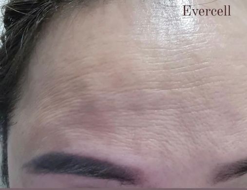 Evercell Deep Wrinkle Solution Cream 10ml