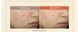 Yugeunpi Soap 100g
